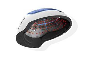 Servicio tecnico láser capilar para el tratamiento de la alopecia